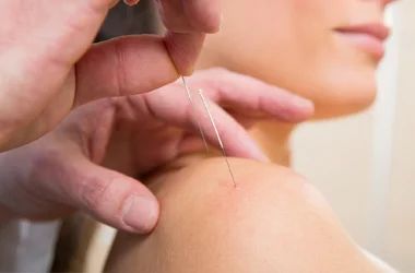 Chiropractic Waldorf MD Dry Needling A practitioner performing a dry needling treatment on a patient's shoulder